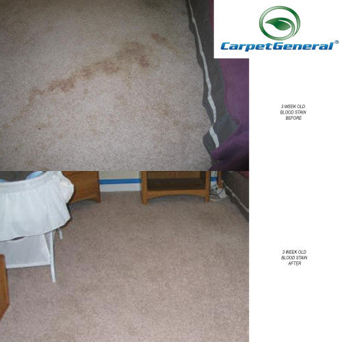 CarpetGeneral Carpet Spot Remover 3931 - Stop Discoloration and Stains for Carpets and Furniture