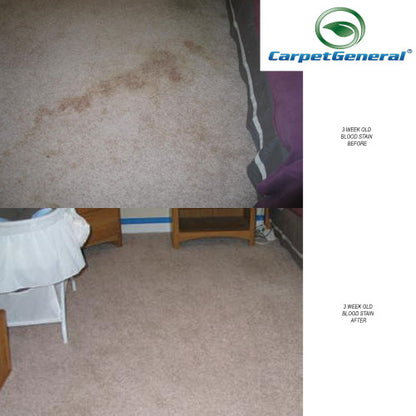 CarpetGeneral Carpet Spot Remover 3931 - Stop Discoloration and Stains for Carpets and Furniture